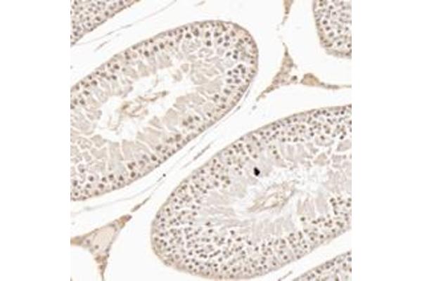 WDR92 antibody