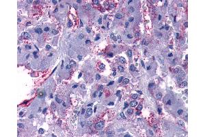 Anti-GPR108 antibody IHC of human adrenal. (GPR108 antibody  (Cytoplasmic Domain))