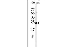 Western blot analysis in Jurkat cell line lysates (35ug/lane). (POLR2J antibody  (C-Term))