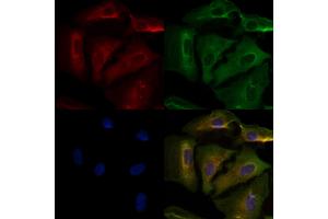 ABIN6259757 and ABIN6276478 staining  cells by IF/ICC.