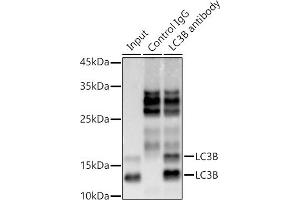 Immunoprecipitation analysis of 300 μg extracts of 293T cells using 3 μg LC3B antibody (ABIN7268519). (LC3B antibody)