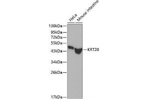 Western blot analysis of extracts of various cell lines using KRT20 Polyclonal Antibody. (KRT20 antibody)