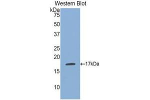Western blot analysis of the recombinant protein. (PLA1A antibody  (AA 148-295))