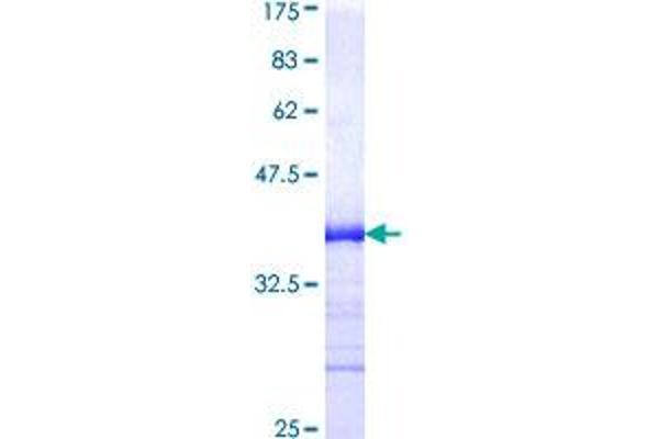 BMPR1A Protein (AA 24-113) (GST tag)