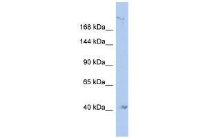 KIF1A antibody used at 1 ug/ml to detect target protein. (KIF1A antibody  (N-Term))