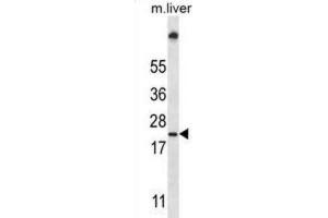 Western Blotting (WB) image for anti-Ubiquitin-Conjugating Enzyme E2W (UBE2W) antibody (ABIN2997430) (UBE2W antibody)