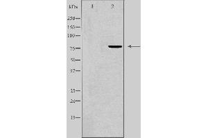 Western blot analysis of extracts from Jurkat cells, using FOXK1 antibody.