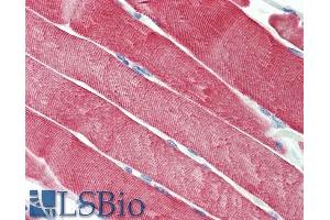 ABIN5539515 (5µg/ml) staining of paraffin embedded Human Skeletal Muscle. (DNAJC5 antibody  (AA 177-191))