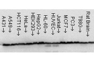 Western Blot analysis of Human Cell line lysates showing detection of Hsp60 protein using Mouse Anti-Hsp60 Monoclonal Antibody, Clone LK-1 . (HSPD1 antibody  (FITC))