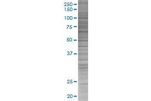 Western Blotting (WB) image for IL18R1 293T Cell Transient Overexpression Lysate(Denatured) (ABIN1334260)