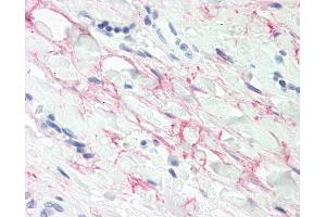 Anti-MFAP4 antibody IHC staining of human tonsil, collagenous stroma. (MFAP4 antibody  (AA 228-255))