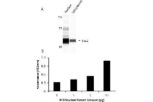 Transcription factor activity assay of SOX2 from nuclear extracts of P19 cells. (SOX2 ELISA Kit)