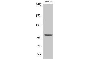 Western Blotting (WB) image for anti-Nuclear Factor of kappa Light Polypeptide Gene Enhancer in B-Cells 1 (NFKB1) (Thr145) antibody (ABIN3185876) (NFKB1 antibody  (Thr145))