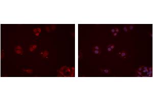 ABIN6277354 staining Hela cells by IF/ICC.