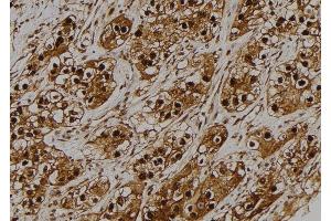 ABIN6275179 at 1/100 staining Human kidney tissue by IHC-P. (GNB5 antibody  (Internal Region))