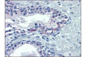 Human Prostate: Formalin-Fixed, Paraffin-Embedded (FFPE) (OR51E1 antibody)