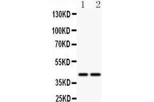 Anti- CD244 antibody, Western blotting All lanes: Anti CD244  at 0. (2B4 antibody  (C-Term))