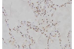 ABIN6277167 at 1/100 staining Human lung tissue by IHC-P. (PPP2R2A antibody  (Internal Region))