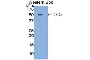 Western blot analysis of the recombinant protein. (FGL2 antibody  (AA 24-439))