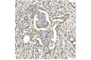 IHC analysis of Aconitase 1/ACO1 using anti-Aconitase 1/ACO1 antibody (ABIN7598988). (Aconitase 1 antibody  (AA 1-137))