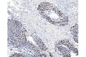 IHC analysis of CHCHD10 using anti-CHCHD10 antibody (ABIN7602507). (CHCHD10 antibody  (AA 80-142))