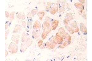 Detection of cTnI in Rat Skin Tissue using Polyclonal Antibody to Cardiac Troponin I (cTnI) (TNNI3 antibody  (AA 1-211))