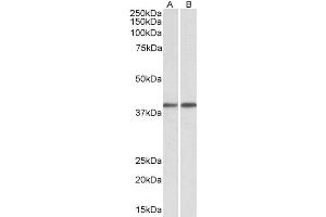 Western Blotting (WB) image for anti-Guanine Nucleotide Binding Protein (G Protein), Q Polypeptide (GNAQ) (AA 162-175) antibody (ABIN625823)