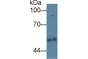 Detection of CPE in Human Urine using Polyclonal Antibody to Carboxypeptidase E (CPE) (CPE antibody  (AA 318-476))