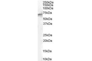 ABIN185613 (1µg/ml) staining of Human Spleen lysate (35µg protein in RIPA buffer). (STAM2 antibody  (Internal Region))