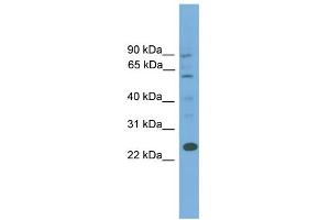 WB Suggested Anti-BCL7A Antibody Titration: 0.