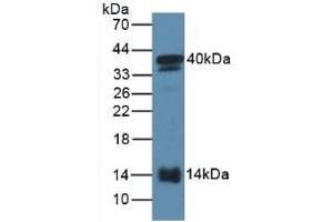 Detection of SAA2 in Mouse Serum using Polyclonal Antibody to Serum Amyloid A2 (SAA2) (SAA2 antibody  (AA 20-122))