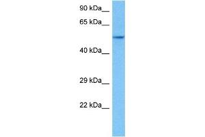 Host:  Rat  Target Name:  HNF4A  Sample Tissue:  Rat Skeletal Muscle  Antibody Dilution:  1ug/ml (HNF4A antibody  (Middle Region))