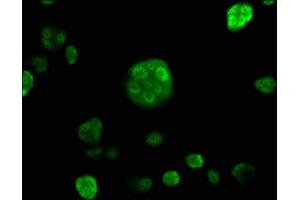 Immunofluorescence staining of MCF-7 cells with ABIN7170614 at 1:120, counter-stained with DAPI. (DDX39B antibody  (AA 2-251))