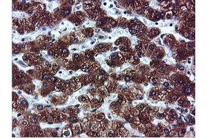 Image no. 15 for anti-IlvB (Bacterial Acetolactate Synthase)-Like (ILVBL) antibody (ABIN1498878)