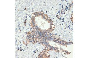 Immunohistochemistry (IHC) image for anti-SMAD, Mothers Against DPP Homolog 5 (SMAD5) (AA 186-465) antibody (ABIN6148090)