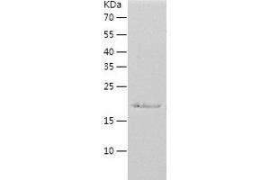 EIF3S1 Protein (AA 70-258) (His tag)