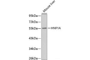 Western blot analysis of extracts of Mouse liver using HNF1A Polyclonal Antibody. (HNF1A antibody)