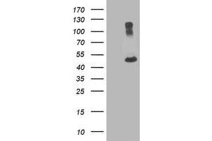 HEK293T cells were transfected with the pCMV6-ENTRY control (Left lane) or pCMV6-ENTRY TUBA8 (Right lane) cDNA for 48 hrs and lysed. (TUBA8 antibody)