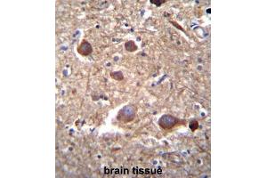 Immunohistochemistry (IHC) image for anti-Inositol-Trisphosphate 3-Kinase B (ITPKB) antibody (ABIN3003734) (ITPKB antibody)