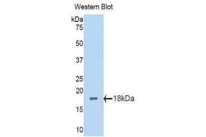 Western Blotting (WB) image for anti-Polybromo 1 (PBRM1) (AA 1152-1273) antibody (ABIN1860135) (Polybromo 1 antibody  (AA 1152-1273))