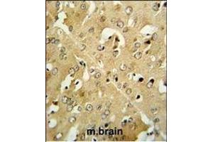 Immunohistochemistry (Paraffin-embedded Sections) (IHC (p)) image for anti-Corticotropin Releasing Hormone Receptor 2 (CRHR2) (AA 243-272) antibody (ABIN390758)
