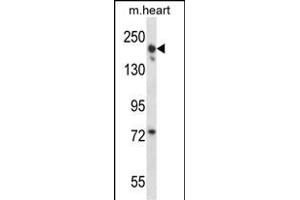 LRRC16B Antibody (C-term) (ABIN657937 and ABIN2846881) western blot analysis in mouse heart tissue lysates (35 μg/lane). (LRRC16B antibody  (C-Term))