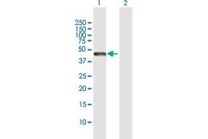Western Blot analysis of STOML2 expression in transfected 293T cell line by STOML2 MaxPab polyclonal antibody. (STOML2 antibody  (AA 1-356))