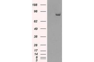 HEK293T cells were transfected with the pCMV6-ENTRY control (Left lane) or pCMV6-ENTRY SATB1 (Right lane) cDNA for 48 hrs and lysed. (SATB1 antibody)