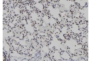 ABIN6277939 at 1/100 staining Rat lung tissue by IHC-P. (T-Bet antibody  (Internal Region))