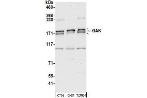 anti-Cyclin G Associated Kinase (GAK) (AA 675-725) antibody