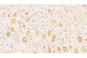 Detection of MAP2 in Rat Cerebellum Tissue using Polyclonal Antibody to Microtubule Associated Protein 2 (MAP2) (MAP2 antibody  (AA 1459-1718))