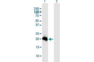 Western Blot analysis of N6AMT1 expression in transfected 293T cell line ( H00029104-T01 ) by N6AMT1 MaxPab polyclonal antibody. (N6AMT1 antibody  (AA 1-186))
