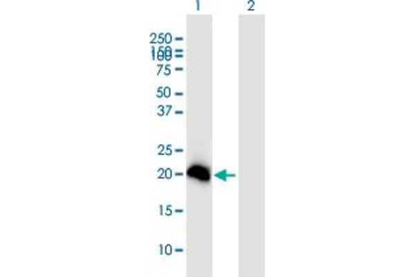 N6AMT1 Antikörper  (AA 1-186)