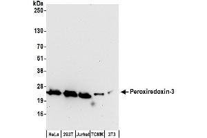 Western Blotting (WB) image for anti-Peroxiredoxin 3 (PRDX3) (AA 206-256) antibody (ABIN7453415)